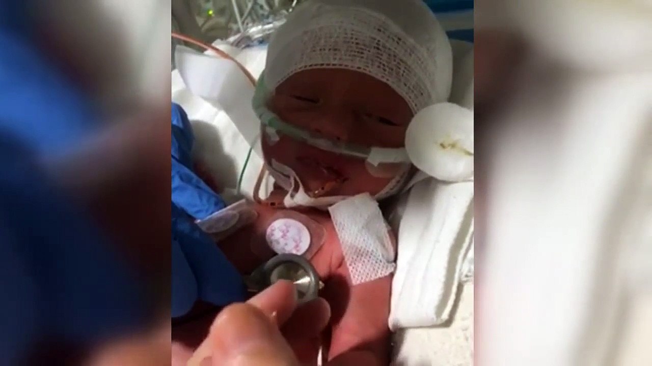 "Yaşamaz" denilen bebek 2 yaşına girdi