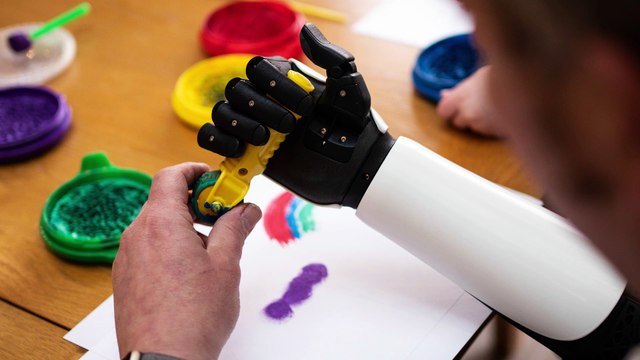 First Military Veteran In The World Receives 3D-printed Bionic Arm!