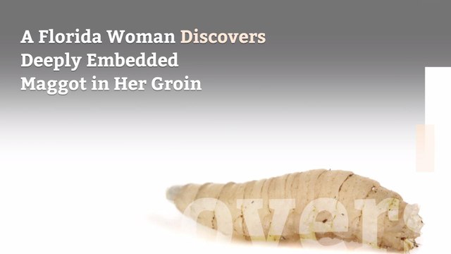 A Florida Woman Discovers Deeply Embedded Maggot in Her Groin