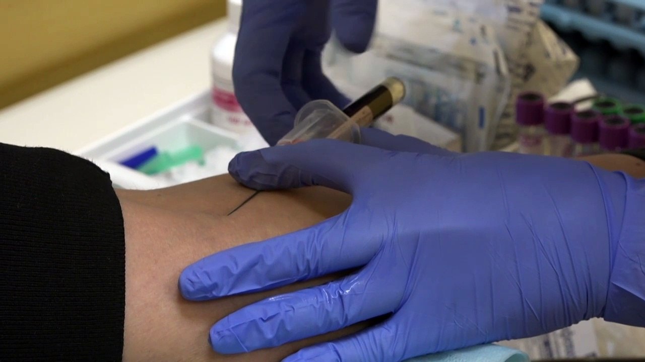 "Biohackers" russos ultrapassam os limites do corpo humano