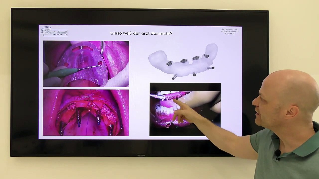 navigierte Implantation - so gehts - so nicht