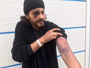 Mısırlı göçmen: Yunan askerleri demir çubukla dövdü