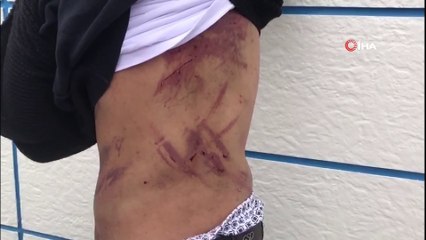 Yunanistan'ın mültecilere zulmü devam ediyor...Bu kez demir çubuklarla dövdüler