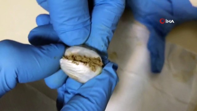 Bağırsağından 47 paket uyuşturucu çıktı 'haberim yok' dedi