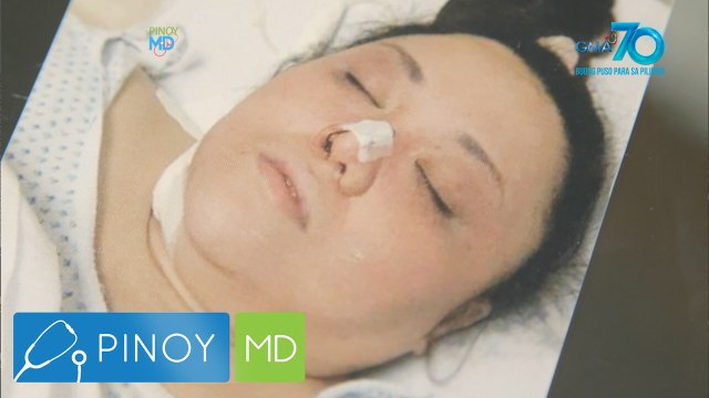 Pinoy MD: Babae, sinimulan ang kanyang #fitnessjourney nang malamang mayroon siyang malubhang kondisyon ang CSF leak!