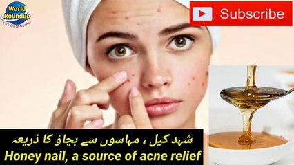 Honey  nail, a Source of Acne Relief || Do the complete elimination of acne with honey