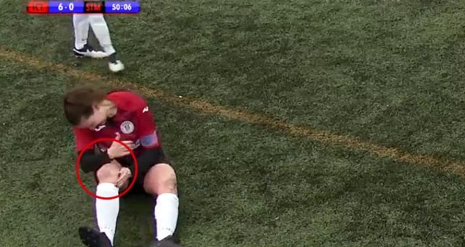 Böylesi daha önce görülmedi! Çıkan diz kapağını yumruklayarak yerine taktı