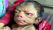 Baby Boy from Bangladesh with Progeria Looks Like an 80 Year Old Video by Facts And Mysteries
