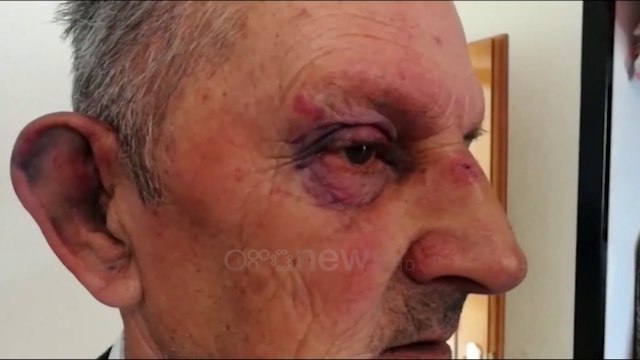 Çifti në Dibër dhunohet dhe grabitet nga 6 persona me kapuçë, policia gjen bosh kutitë