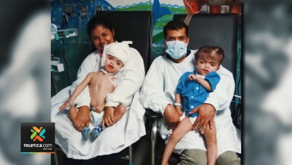 tn7-separacion-de-siameses-240220