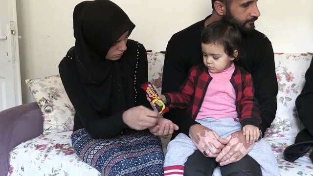 İki yaşındaki Ecem Naz kendisini hayata bağlayacak kalp bekliyor - KAHRAMANMARAŞ