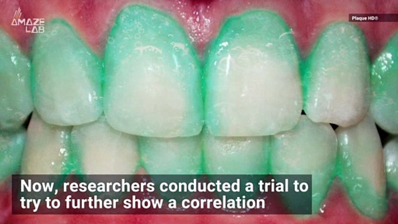 First Plaque-Identifying Toothpaste May Prevent Heart Attack and Stroke
