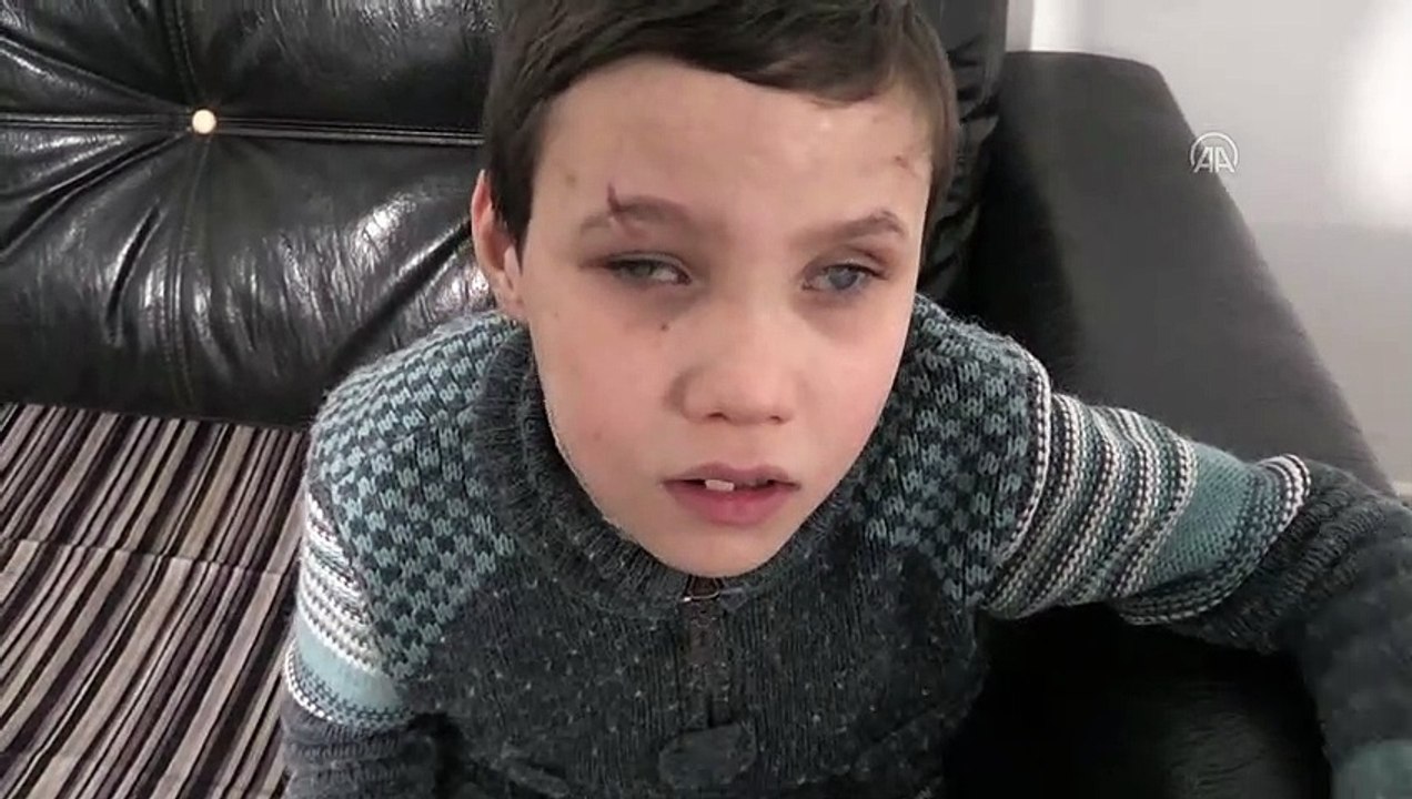 İdlibli küçük Muhammed savaşın kararttığı gözlerine yeniden kavuşmak istiyor - HATAY