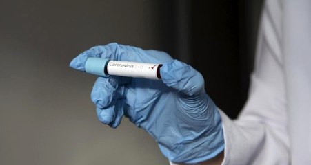 Son Dakika: İran Sağlık Bakanı Yardımcısı koronavirüse yakalandı