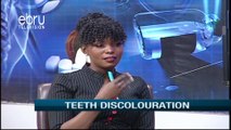 Risk Factors For Developing Tooth Discoloration