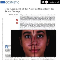 The Alignment of the Nose in Rhinoplasty: Fix Down Concept