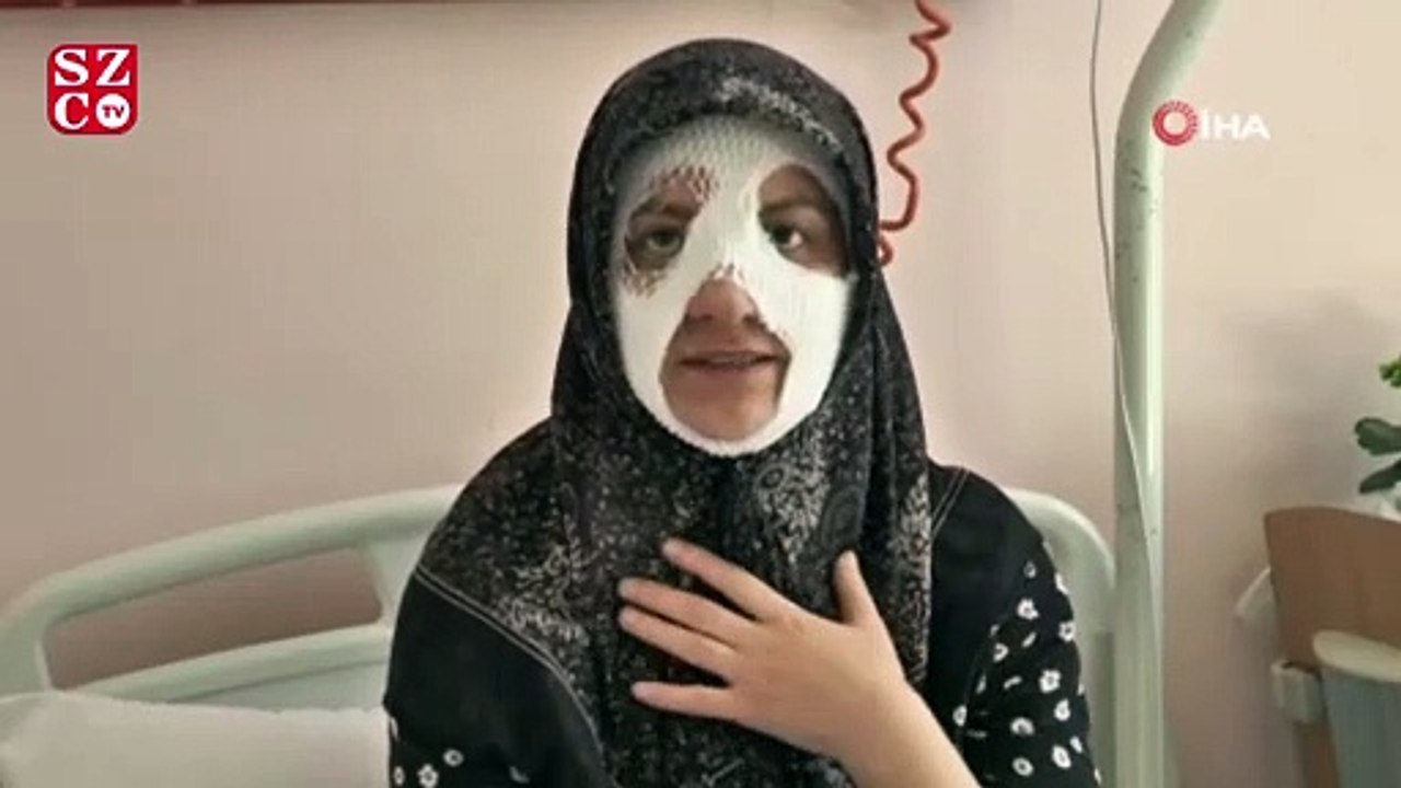 Bomba gibi patlayan düdüklü tencere genç kadına dehşeti yaşattı