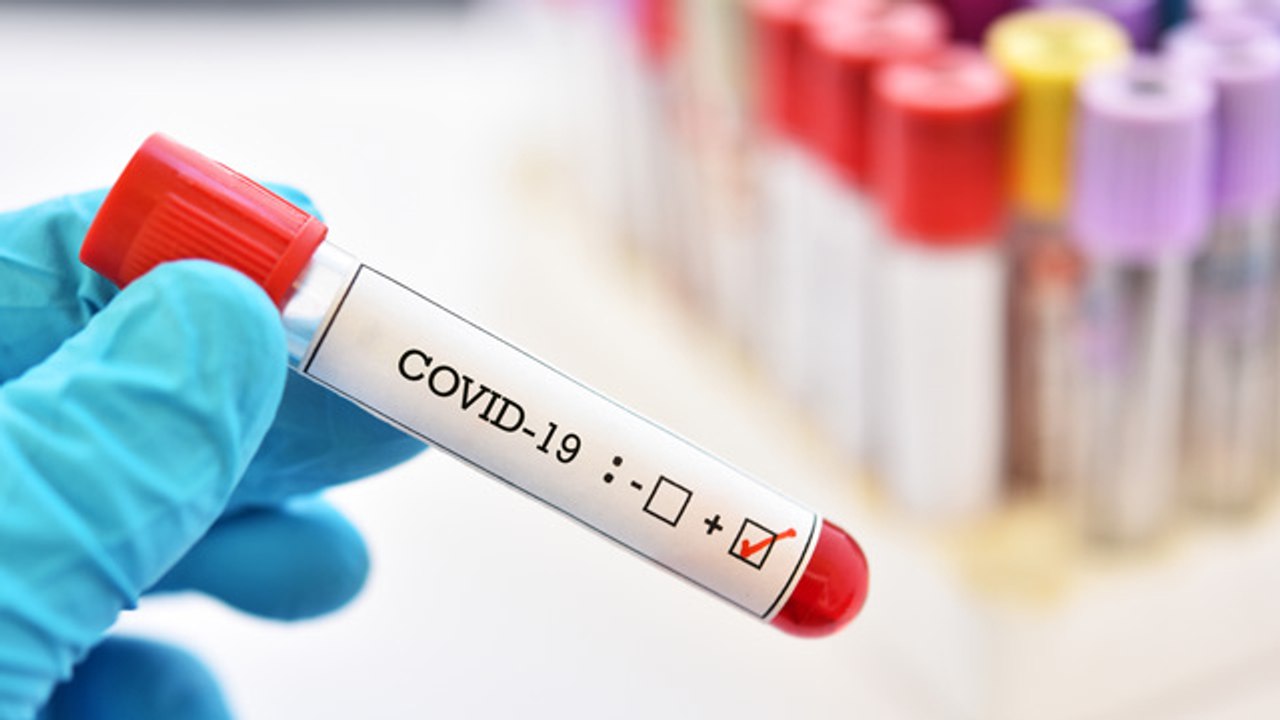 Todo lo que debes saber sobre el coronavirus