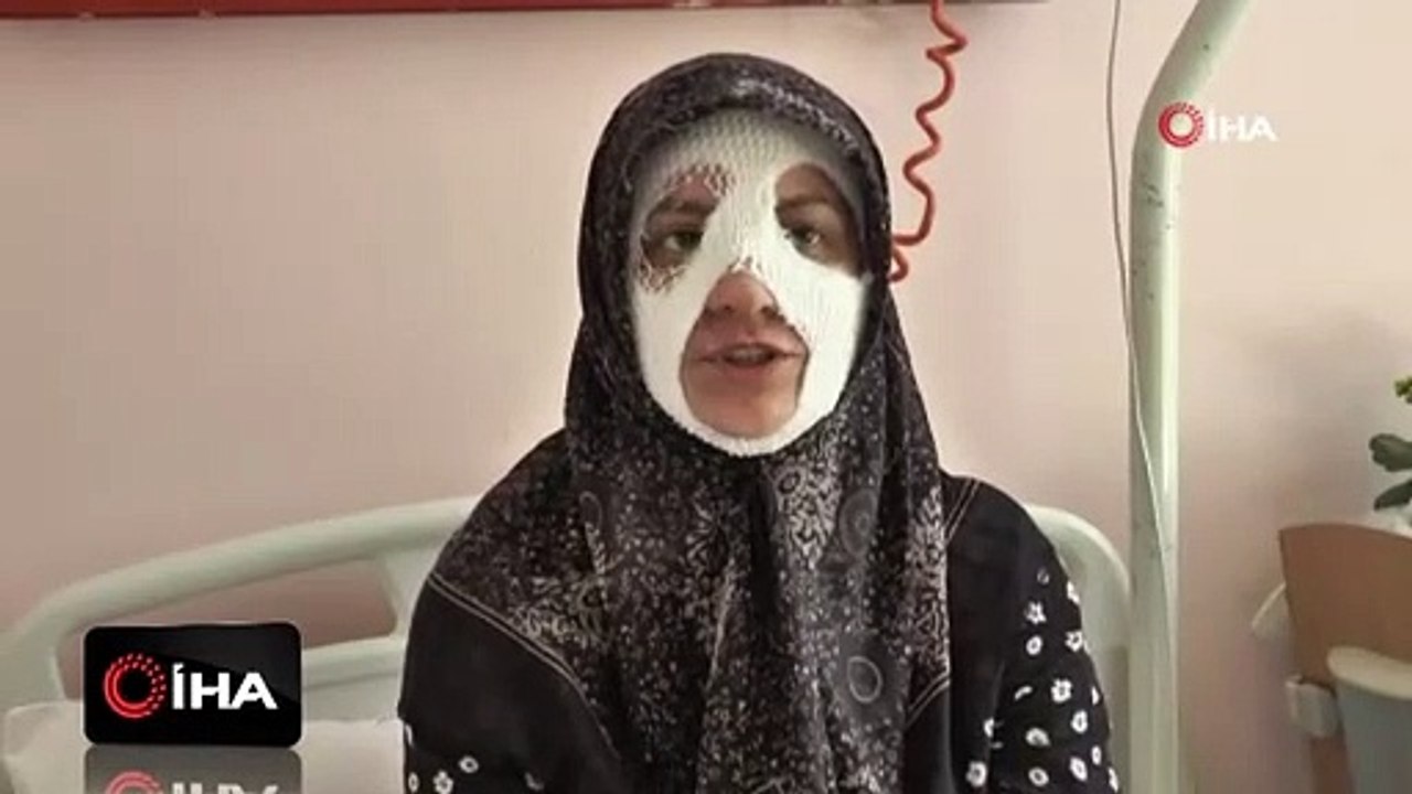 Bomba gibi patlayan tencere onu bu hale getirdi