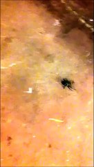 Il écrase une grosse araignée et va le regretter de suite