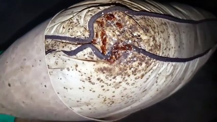 Invasion de punaises de lit, voilà le résultat