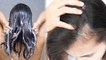 30 की उम्र के बाद तेजी से झड़ते है बाल, इस Tips से रोकें HAIR FALL | How To Stop Hair Fall | Boldsky
