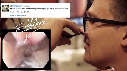 La laringe puede ser así de horrible y fascinante