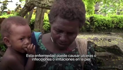 El médico que encontró la cura al Pian, una enfermedad endémica mundial