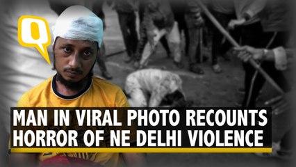 Delhi Violence: ‘Mob Saw My Cap, Beard & Pounced At Me,' Says Man in Viral Photo