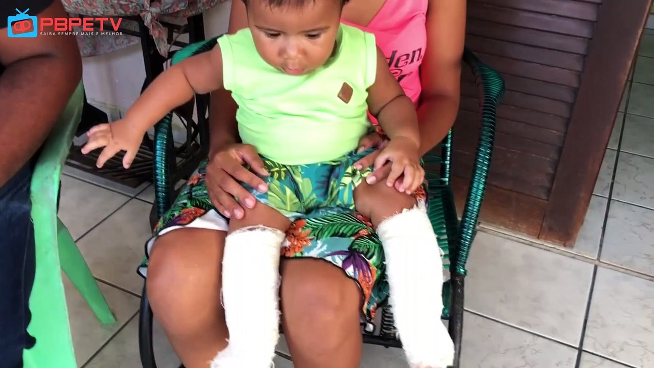 CRIANÇA DE PEDRAS DE FOGO PRECISA DE PRÓTESES PARA AS PERNAS