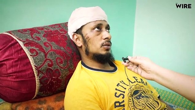 They Attacked Me for My Beard, Cap, Says Zubair, Whose Brutal Beating Sent Shockwaves the World Over