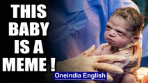 Viral pictures: Baby stares down doctors just moments after birth | Oneindia News