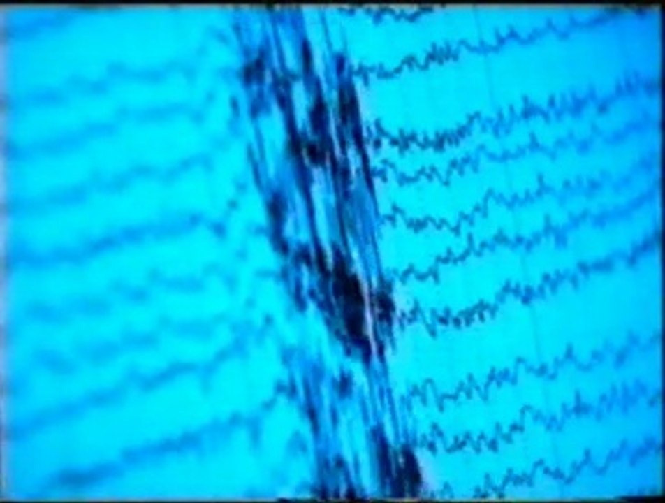 Lobulo frontal: Flujo de consciencia
