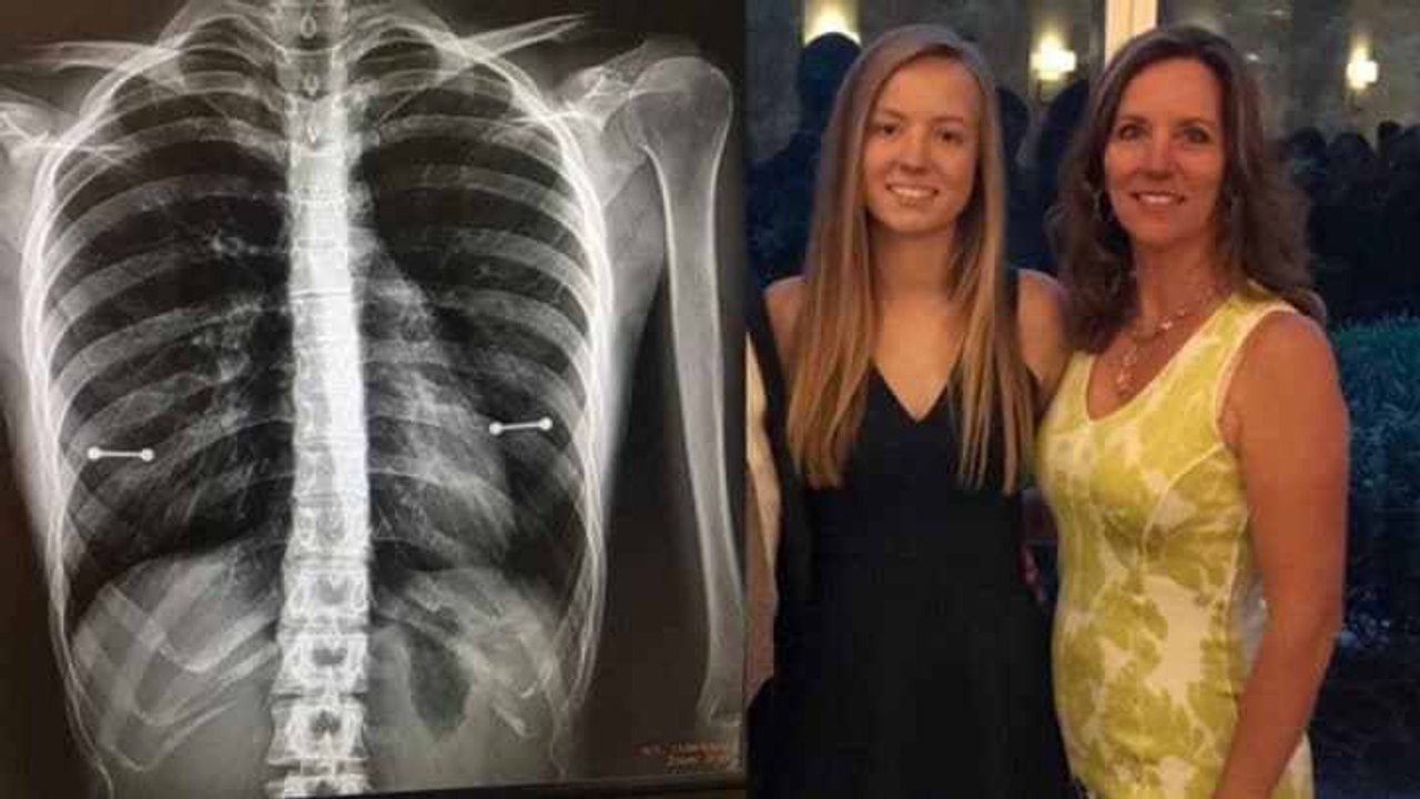 Elle découvre les piercings cachés de sa fille d'une façon géniale