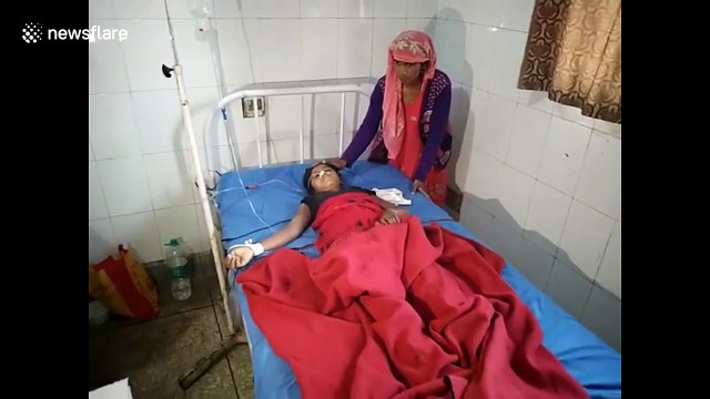 Doctors remove 3-kg hairball from stomach of 15-year-old girl in northern India