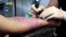 The Risks and Costs of Tattoo Removal