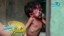 Tunay na Buhay: Batang may Langerhans cell histiocytosis, kilalanin sa 'Tunay na Buhay'!
