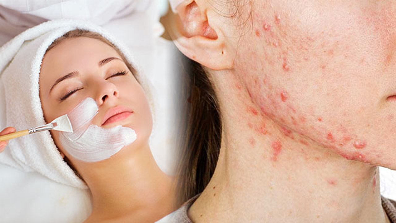 अगली बार Facial करवाने से पहले ये Video जरूर दे...