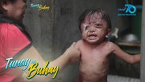 Tunay na Buhay: Tatlong taong gulang na bata, patuloy na lumalaban sa sakit na Langerhans Cells Hystiocytosis