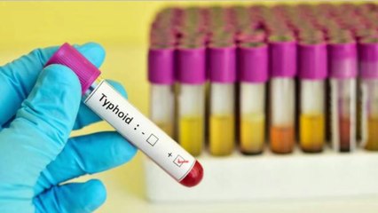 Waspadalah dengan Bakteri Salmonella