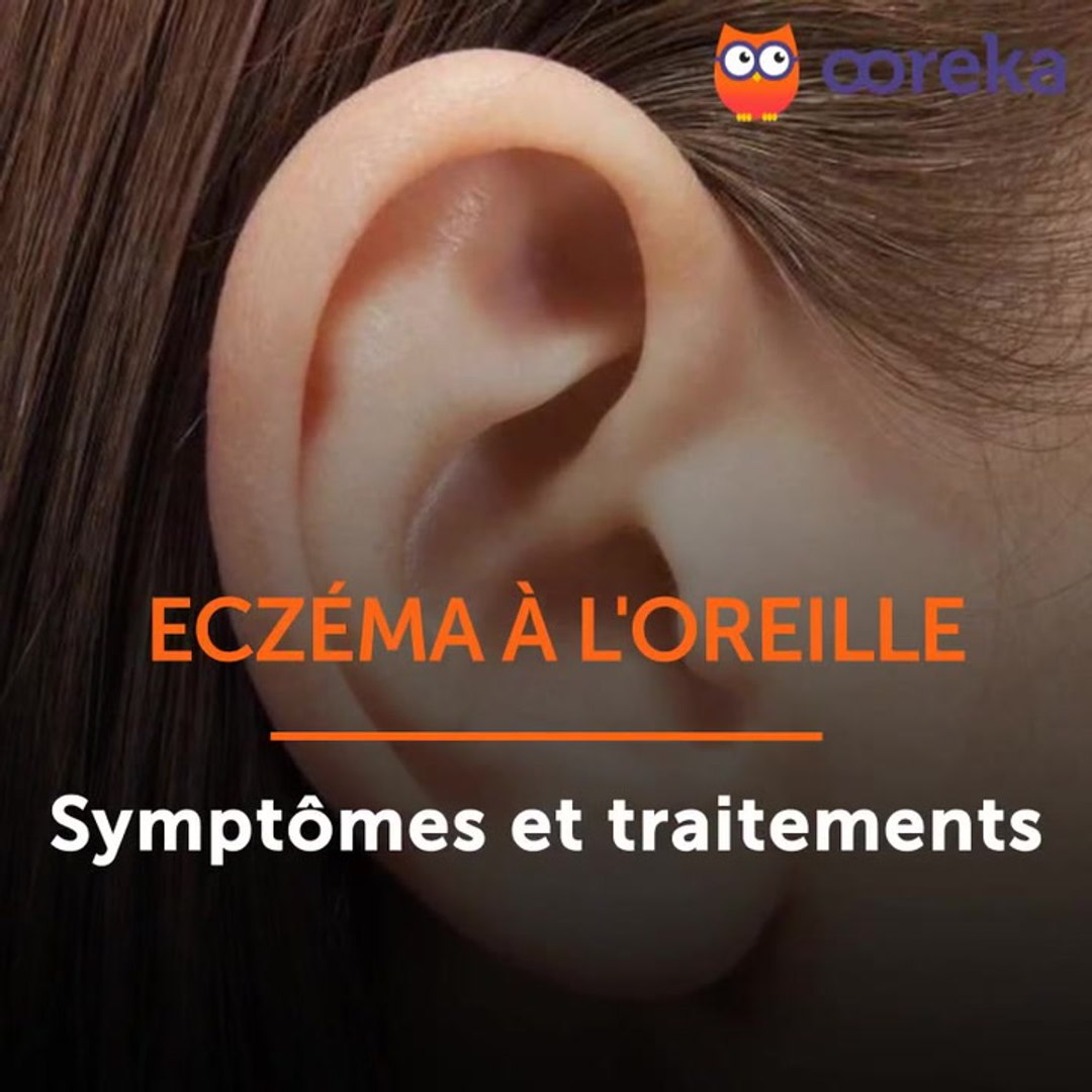 Eczéma dans l'oreille - Vidéo Dailymotion