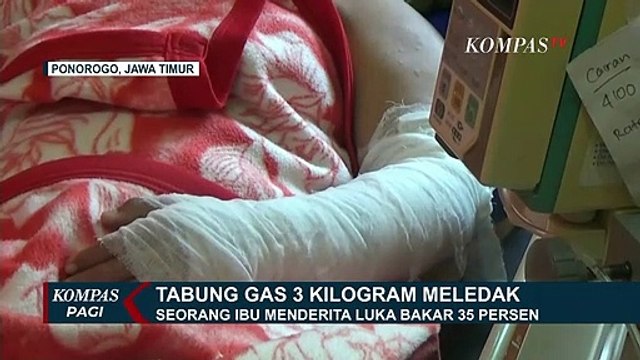 Seorang Ibu Kena Luka Bakar Serius Setelah Pasang Gas LPJ 3 Kg