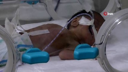 Türkiye'de her yıl 200 bin bebek prematüre doğuyor