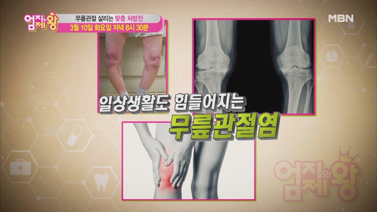 엄지의 제왕 373회 [무릎 관절 살리는 맞춤 처방전]