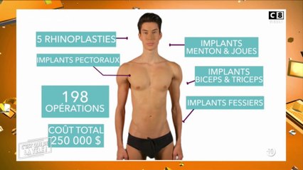 Il fait 90 opérations et dépense 250 000 dollars pour ressembler à Ken !