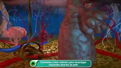 Cientistas criam método para recarregar implantes através da pele