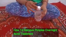 How to Get Rid of pimples,Acne Overnight! 100%working tips