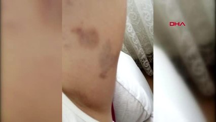 ANNEDEN OTİZMLİ ÇOCUĞUM OKULDA DÖVÜLDÜ İDDİASI