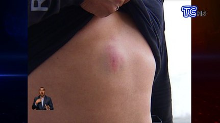 Saca pinta disparó cinco veces a un miembro de la Policía Nacional