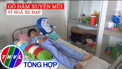 Ngã xe đạp, bé trai 8 tuổi bị khúc gỗ đâm xuyên mũi